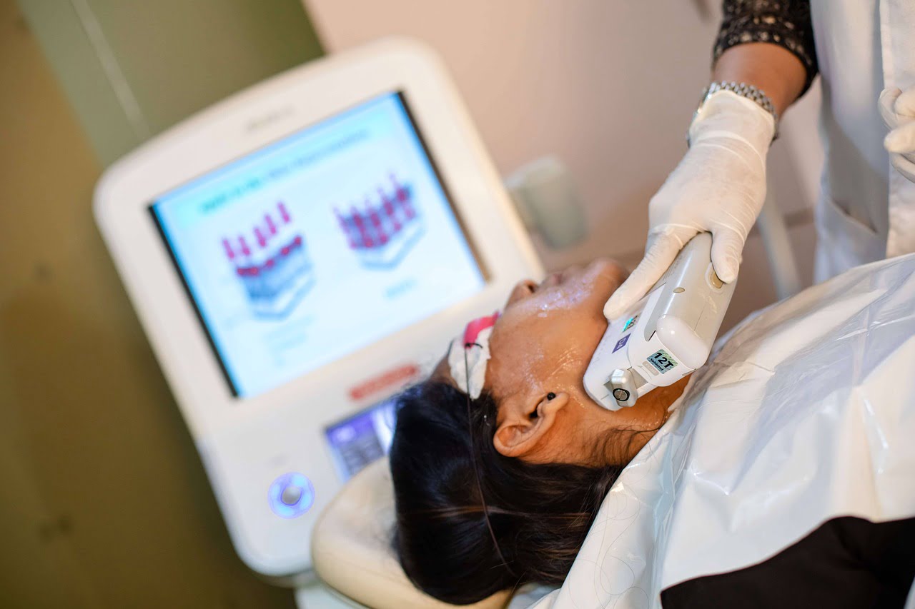 Épilation laser vs lumière pulsée (IPL) : quelle technique choisir ?